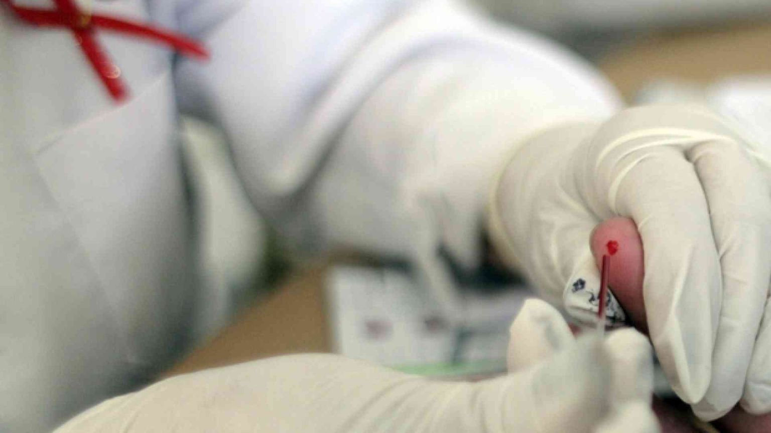 Giovane ricercatrice contagiata in laboratorio da virus dell'Hiv