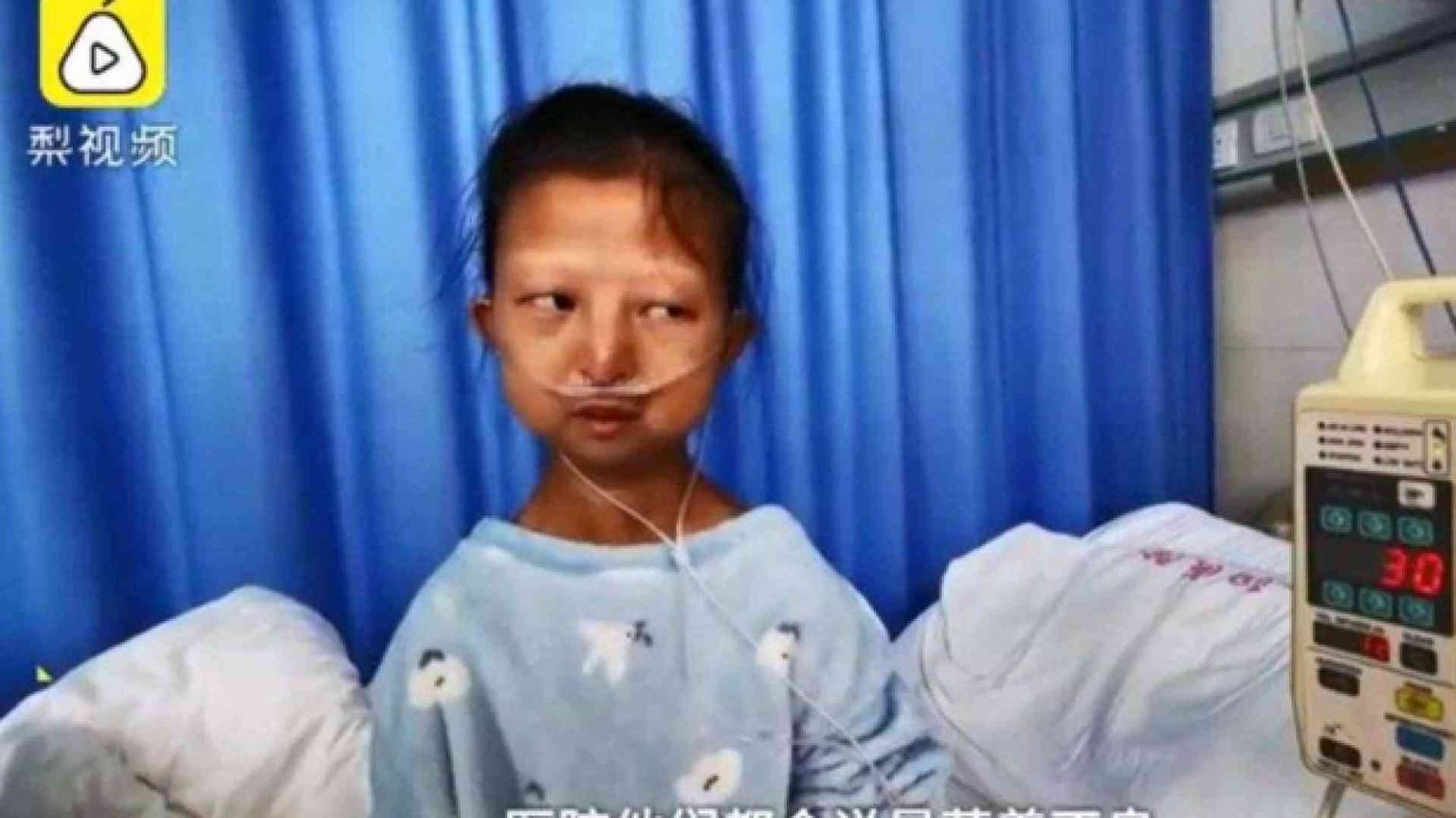 L'agonia di Wu Huayan morta di denutrizione per curare il fratello disabile