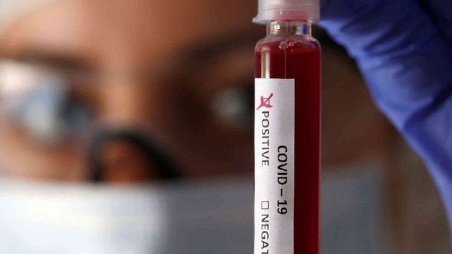 Ecco come gli antivirali e gli antireumatoidi curano i contagiati