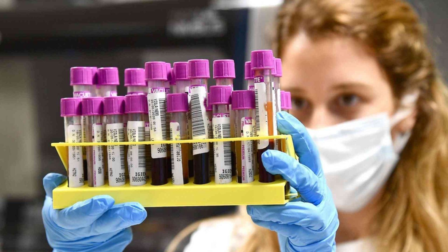 Guariti o dimessi? Ecco i segni che il Covid lascia (almeno per un po')