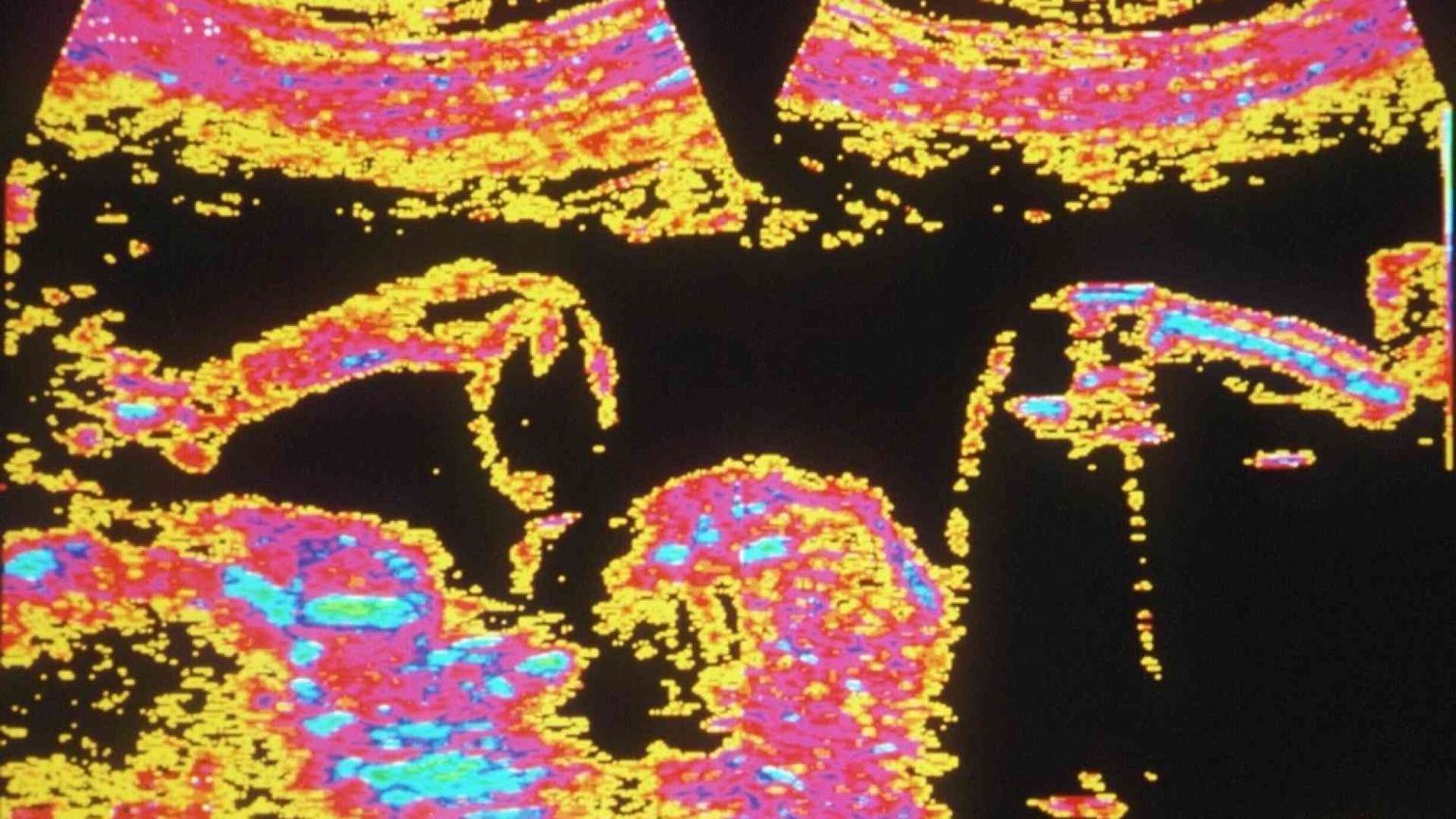 Francia: "diritto di abortire", colpo di mano in Parlamento