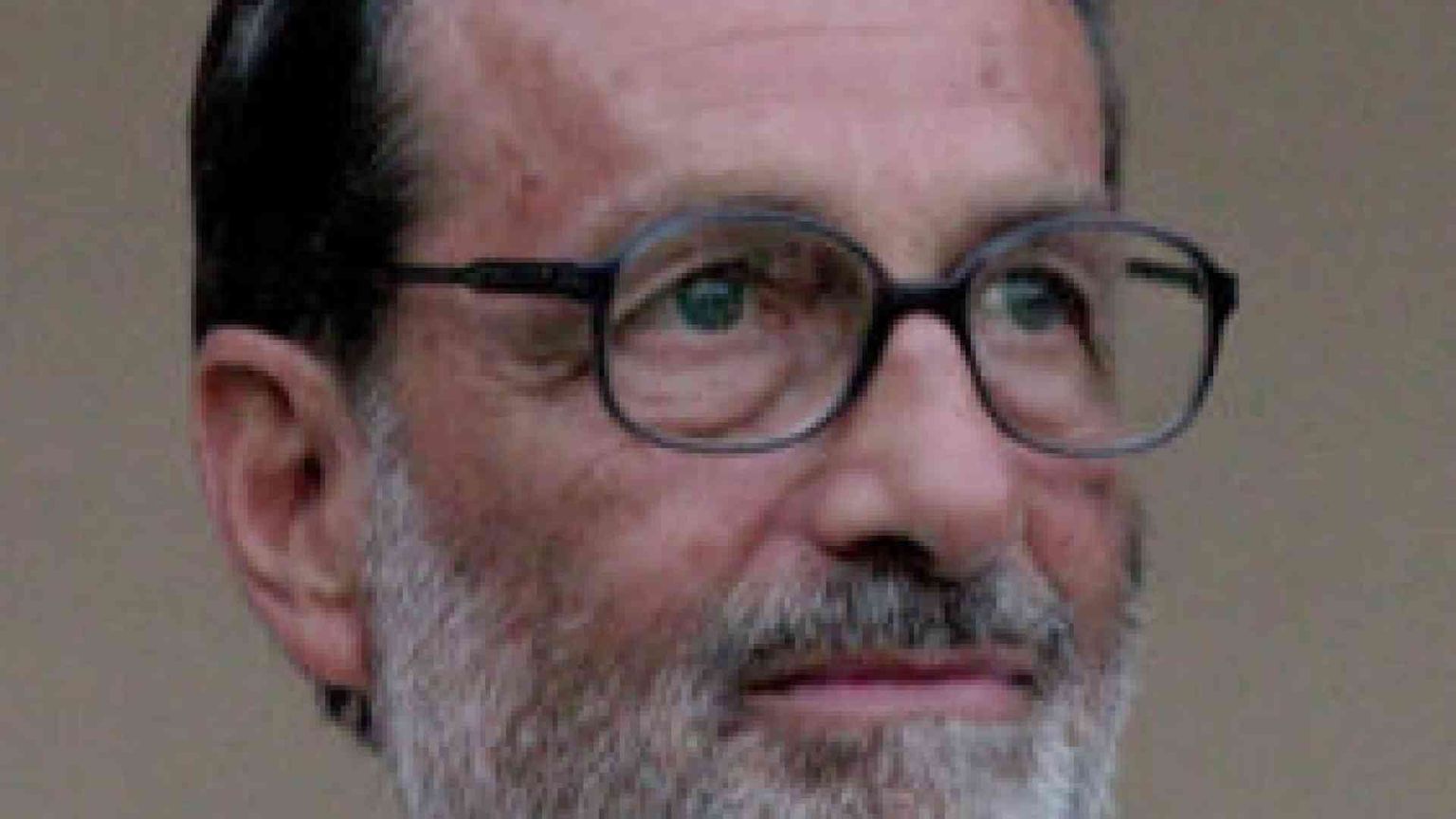 Dilemma delle Rsa e fattore Alzheimer