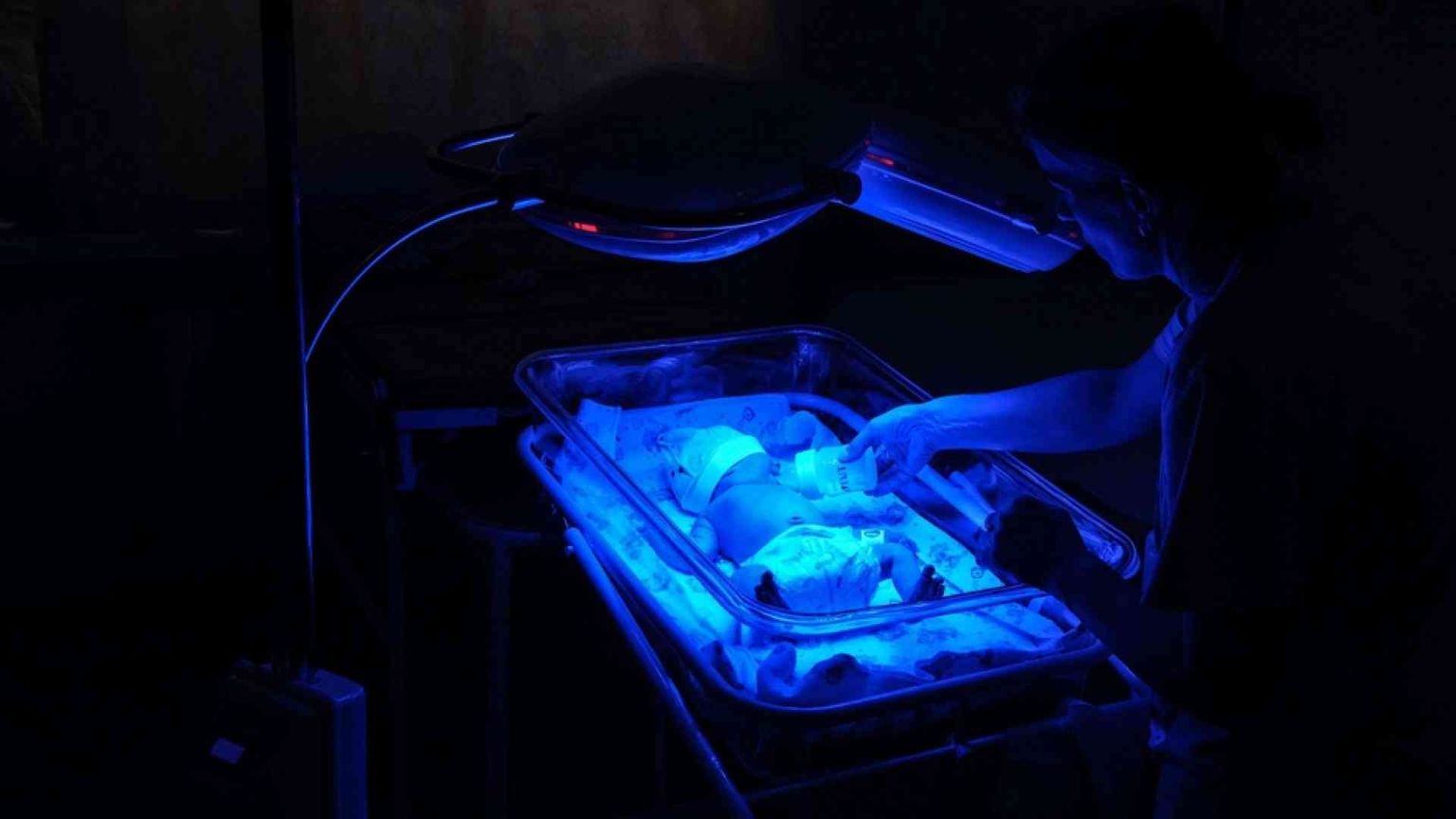 "Troppa paura e stress": aumentano i parti prematuri