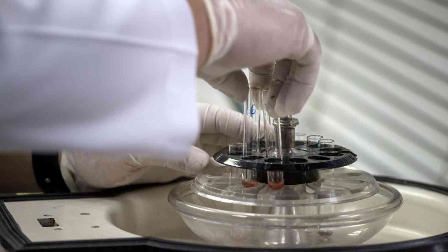 Creato in laboratorio uno pseudo-embrione umano sintetico, un salto nel vuoto?