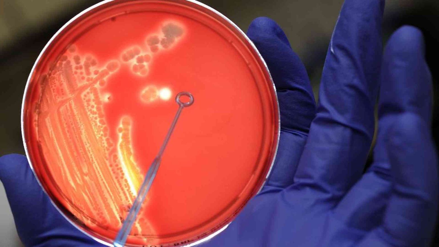 Un nuovo antibiotico contro il batterio killer
