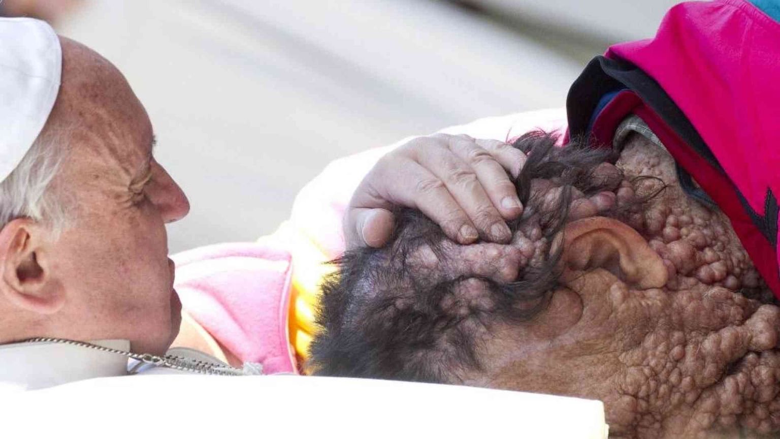 È morto Vinicio Riva, l'abbraccio con papa Francesco aveva commosso il mondo