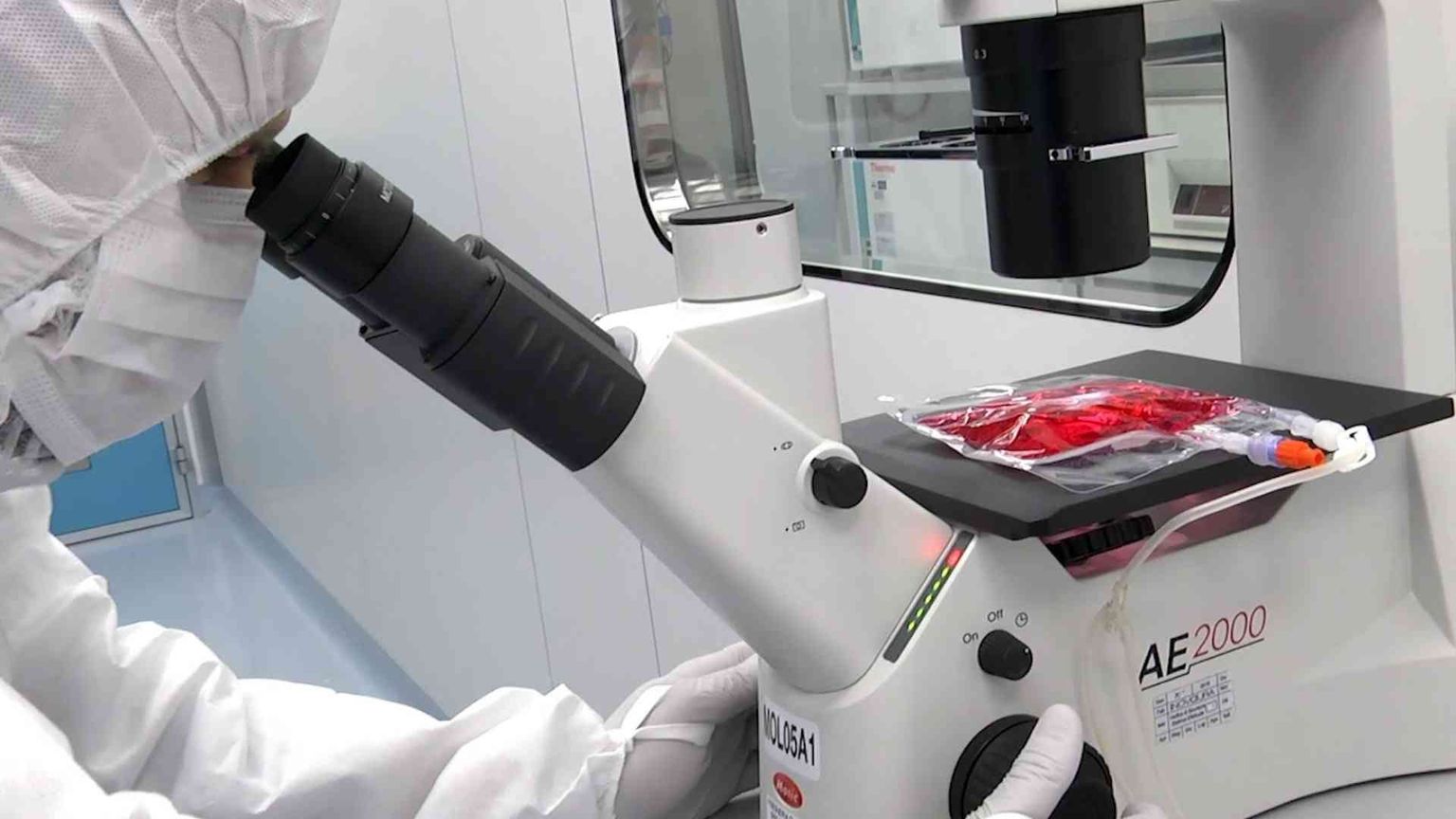 Cellule Car-T in ragazzi con gravi malattie autoimmuni: stanno bene