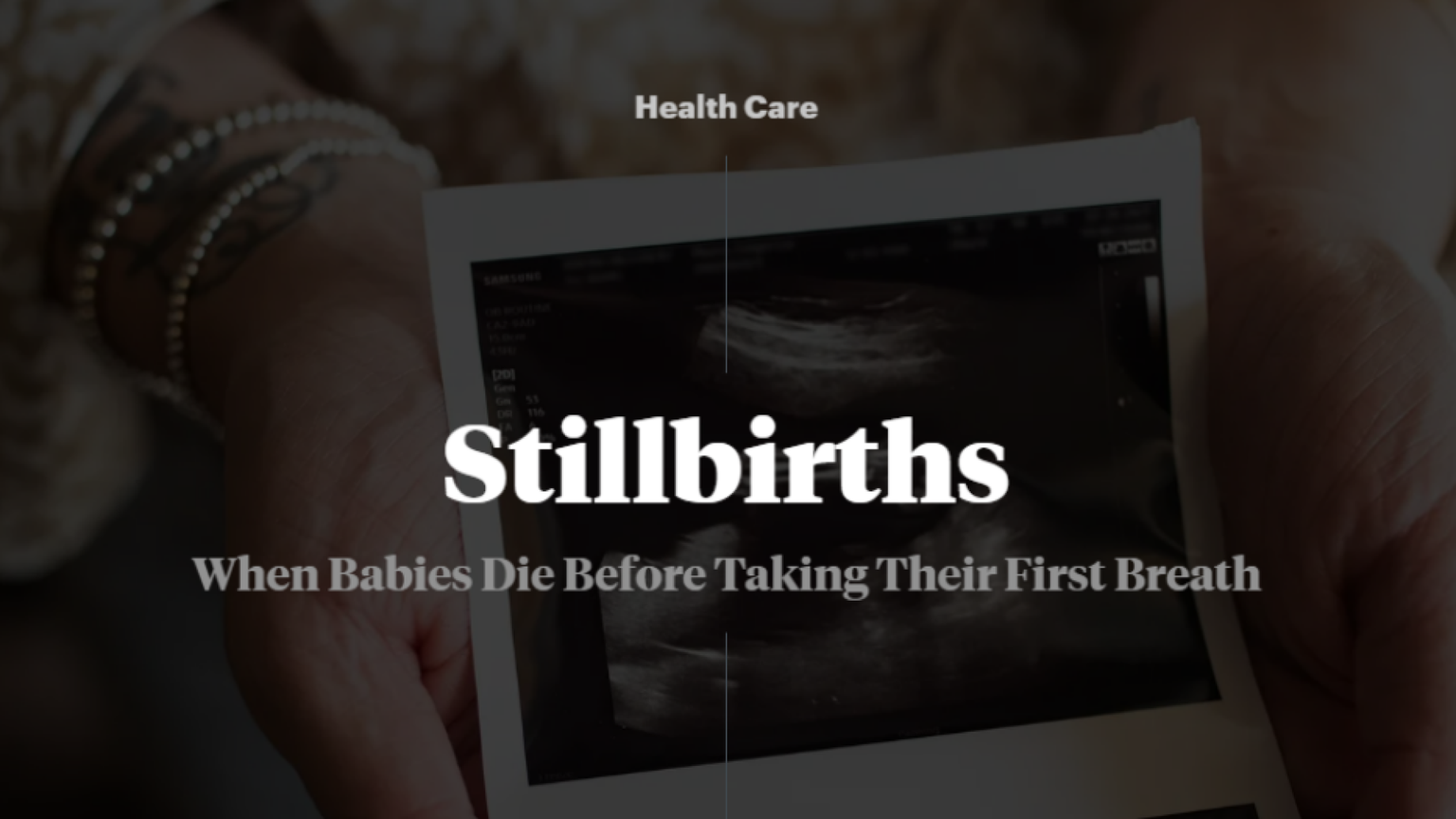 «Stillbirths»: un memoriale online dà un nome ai bimbi nati morti