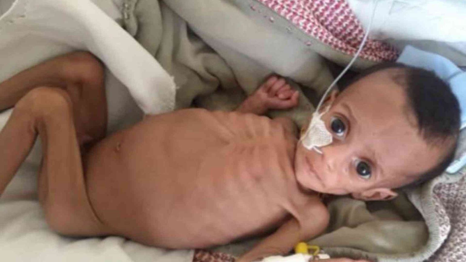 Tigrai 2024, la fame dimenticata: così muoiono in silenzio mamme e neonati