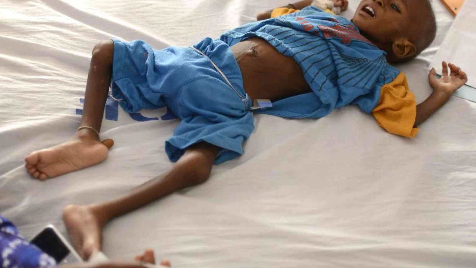 L'Onu: il mondo ha risorse per sfamare tutti, ma uno su 10 è senza cibo