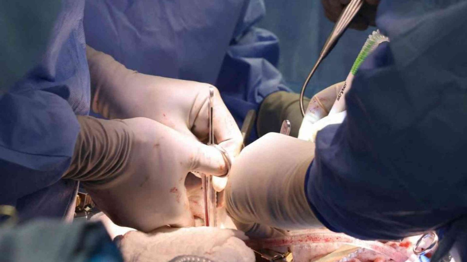 Organi da animali, tutti gli interrogativi etici