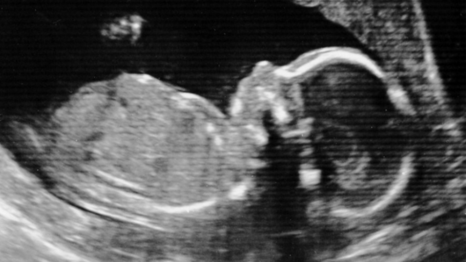 L’ecografia che zittisce e il silenzio sulle nostre ipocrisie