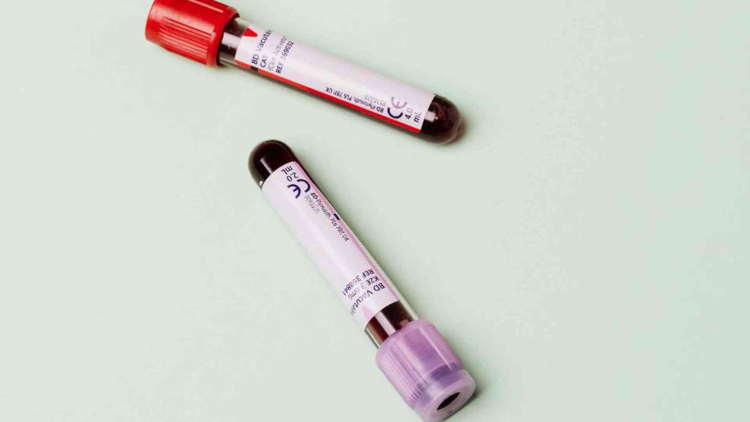 «Donazioni di sangue e plasma, mancano i medici per raccoglierle»