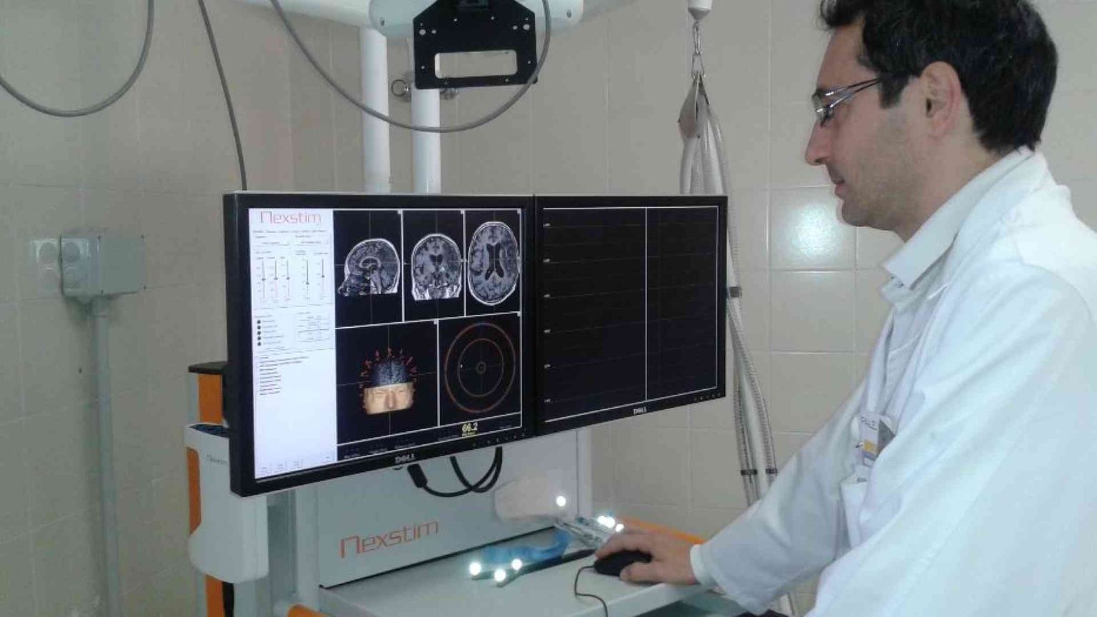 Un test del sangue potrebbe aiutare a diagnosticare il Parkinson 7 anni prima