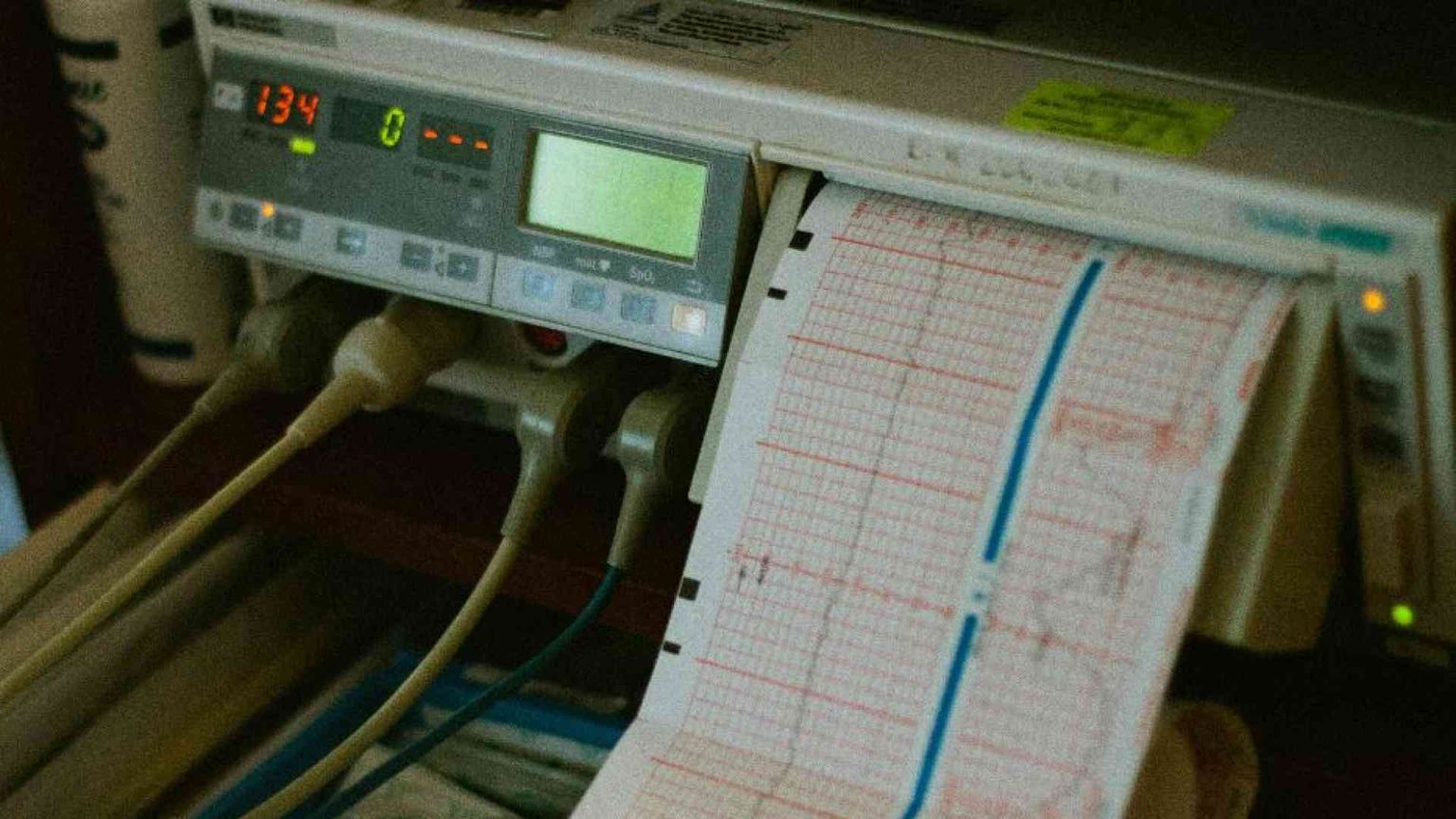 I confini (indispensabili) dei “trattamenti di sostegno vitale”