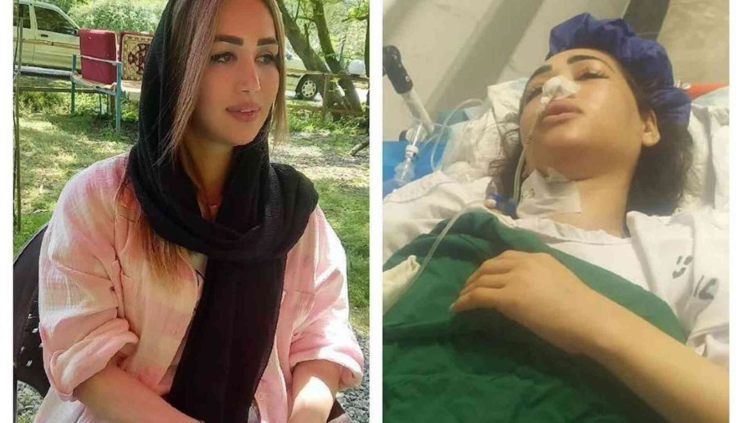 Donna viola la legge sul velo, la polizia spara e resta paralizzata