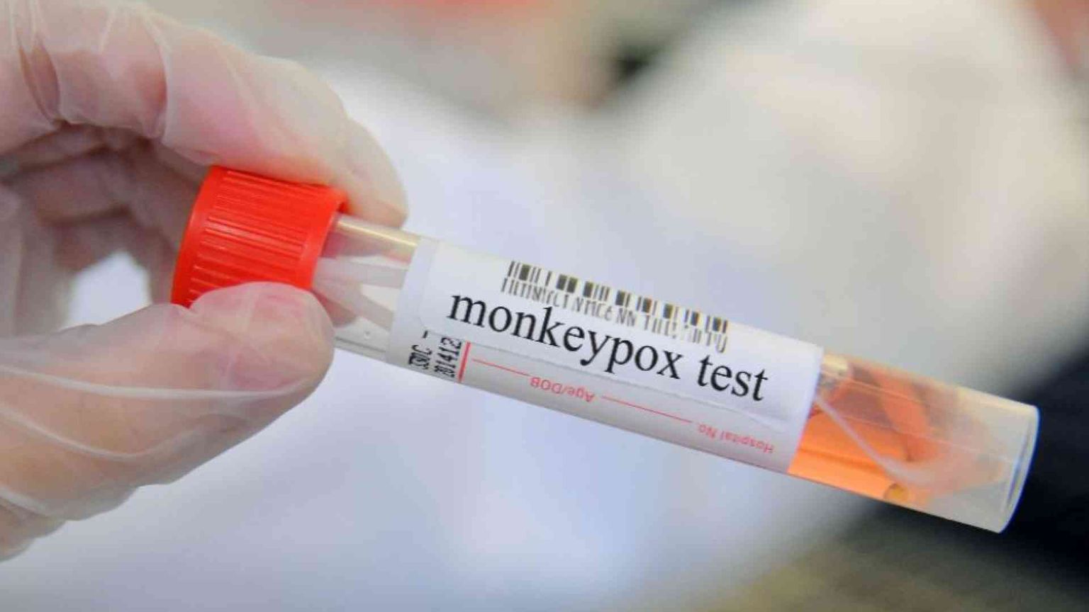 Contatti, viaggi, rischi: tutte le raccomandazioni sul vaiolo delle scimmie