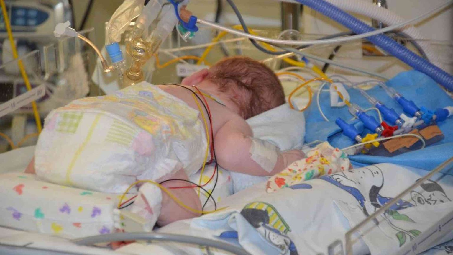 Il farmaco gratis, il Sud escluso, la rettifica: la bronchiolite è un caso