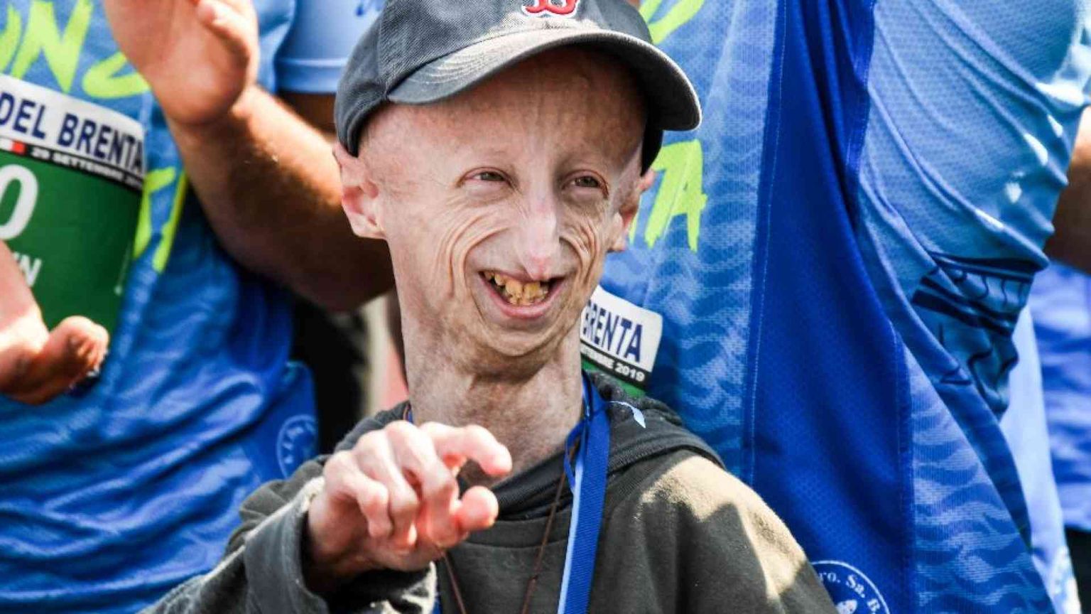 «Che dono la vita»: la lettera scritta da Sammy Basso per il suo funerale