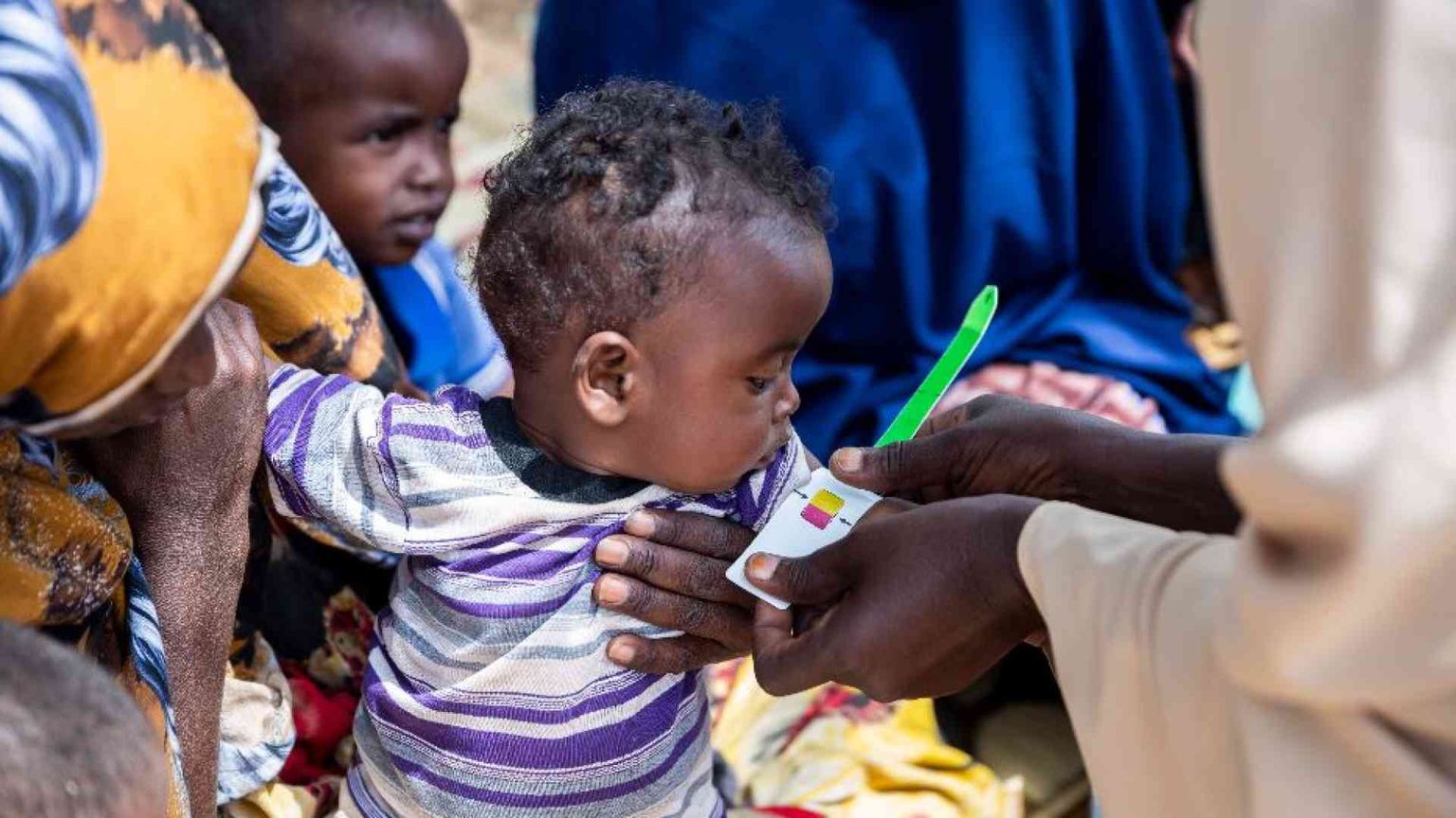 Quando la fame mangia i bambini: denutriti 27 milioni nel 2022. A Gaza il 96%