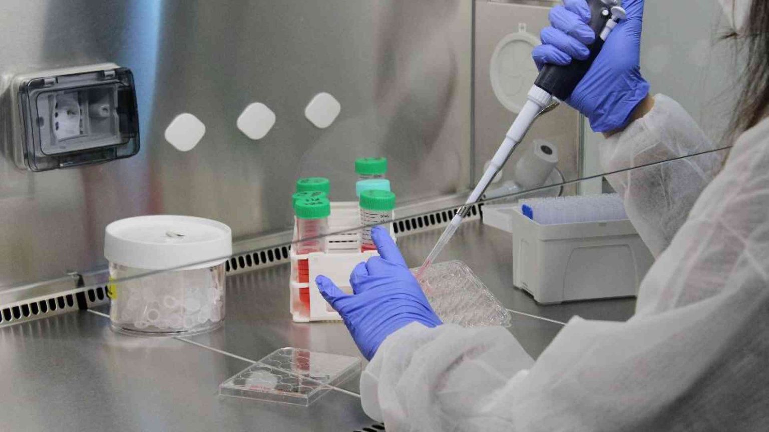 Speranze di cura per la forma genetica più comune di Sla