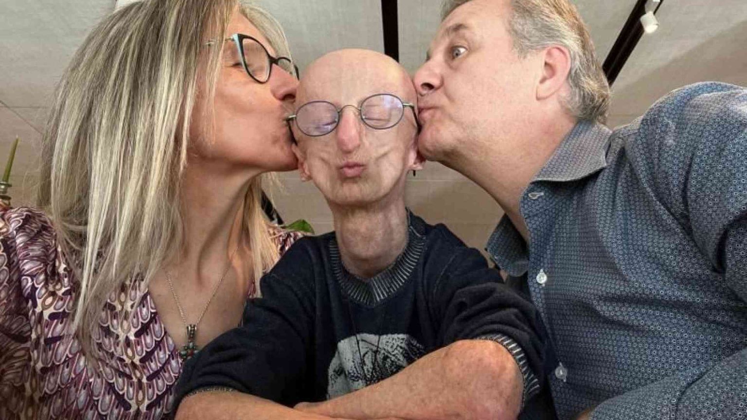 I genitori di Sammy Basso: «Ci ha insegnato a vivere una vita piena»