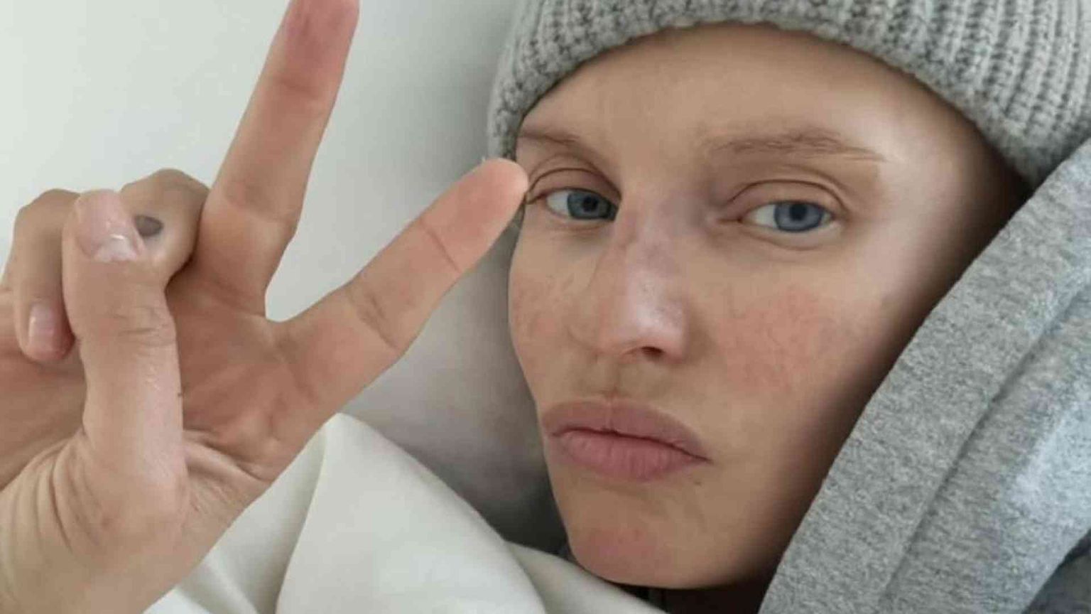 Bianca Balti a Sanremo, la malattia raccontata col sorriso