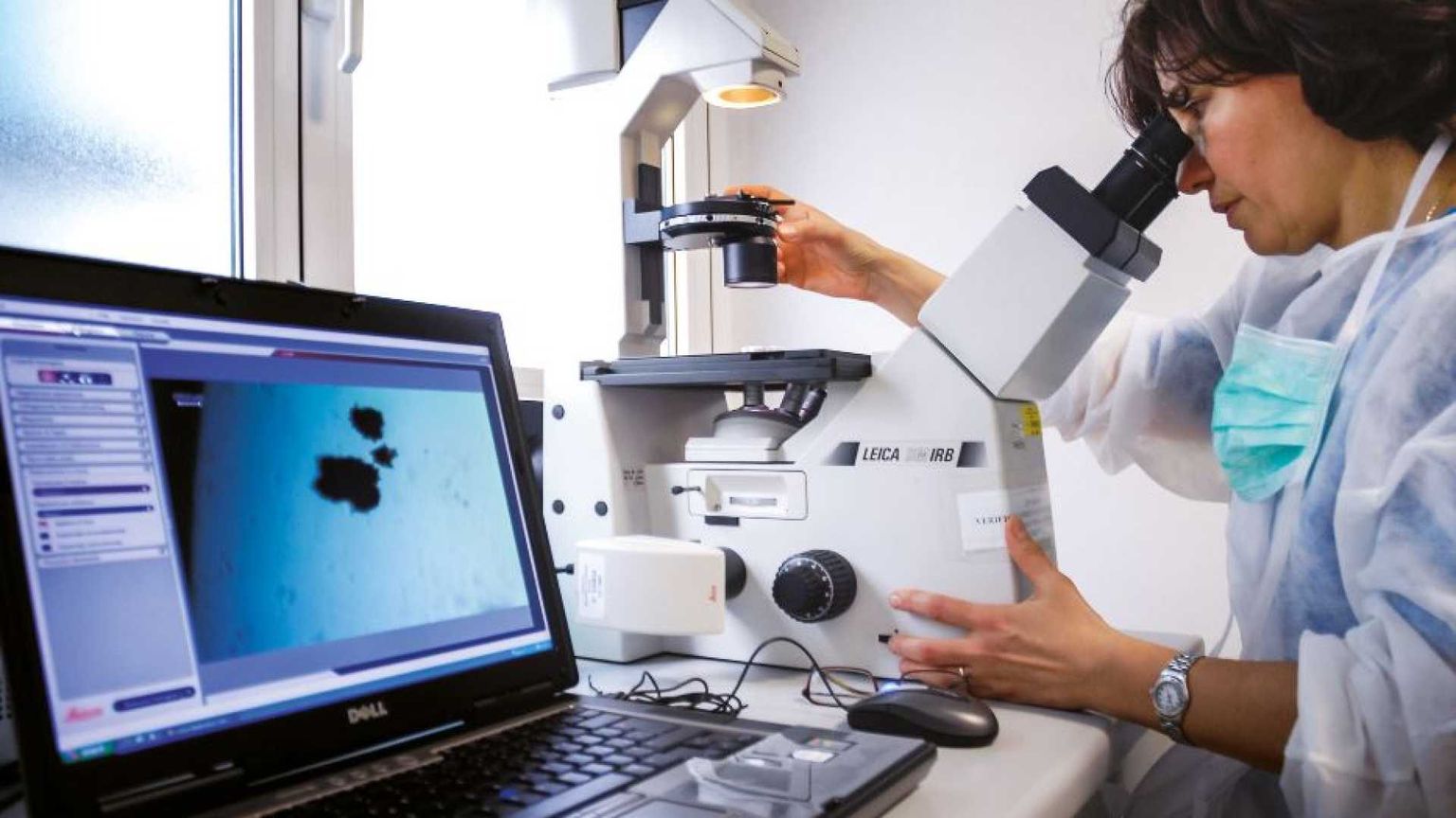 I fumatori possono anticipare le mosse del cancro. Ecco come