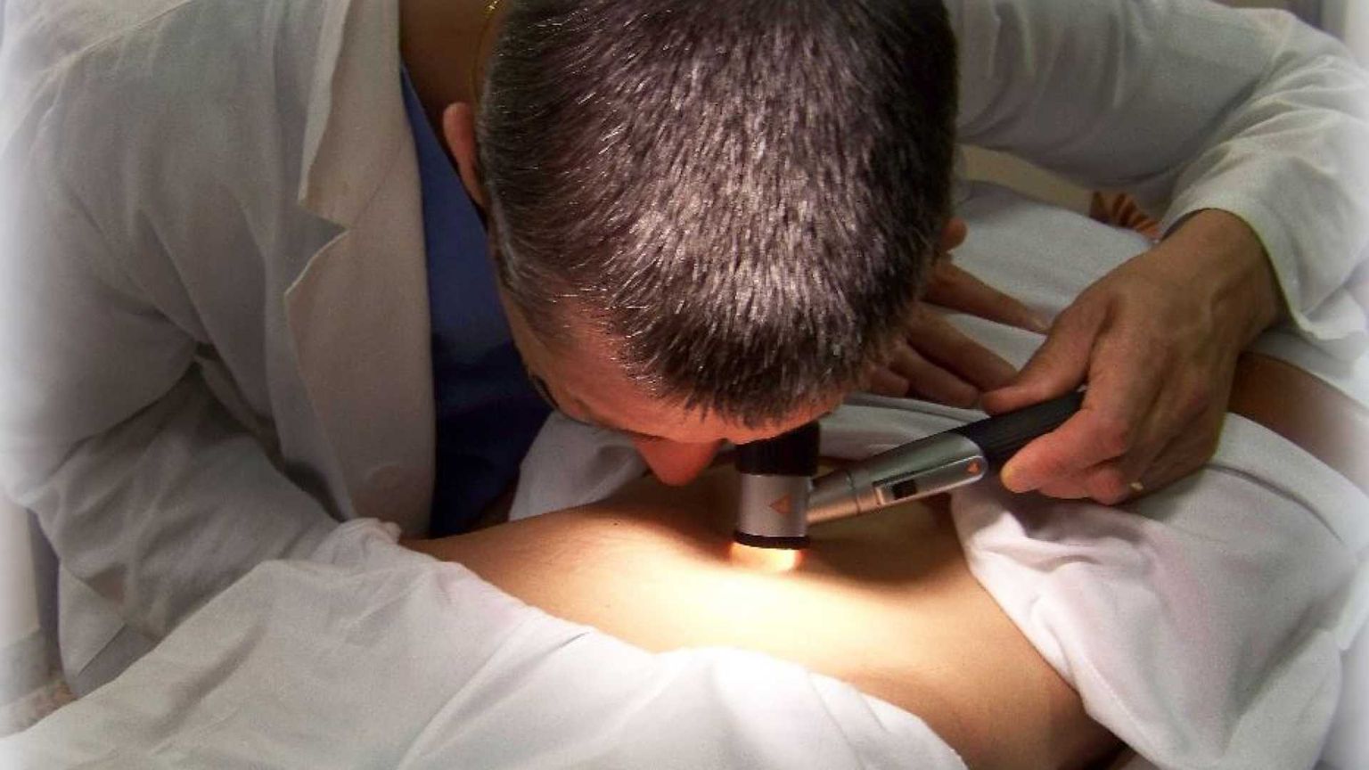 Giovedì 19 a Roma screening dermatologici gratuiti