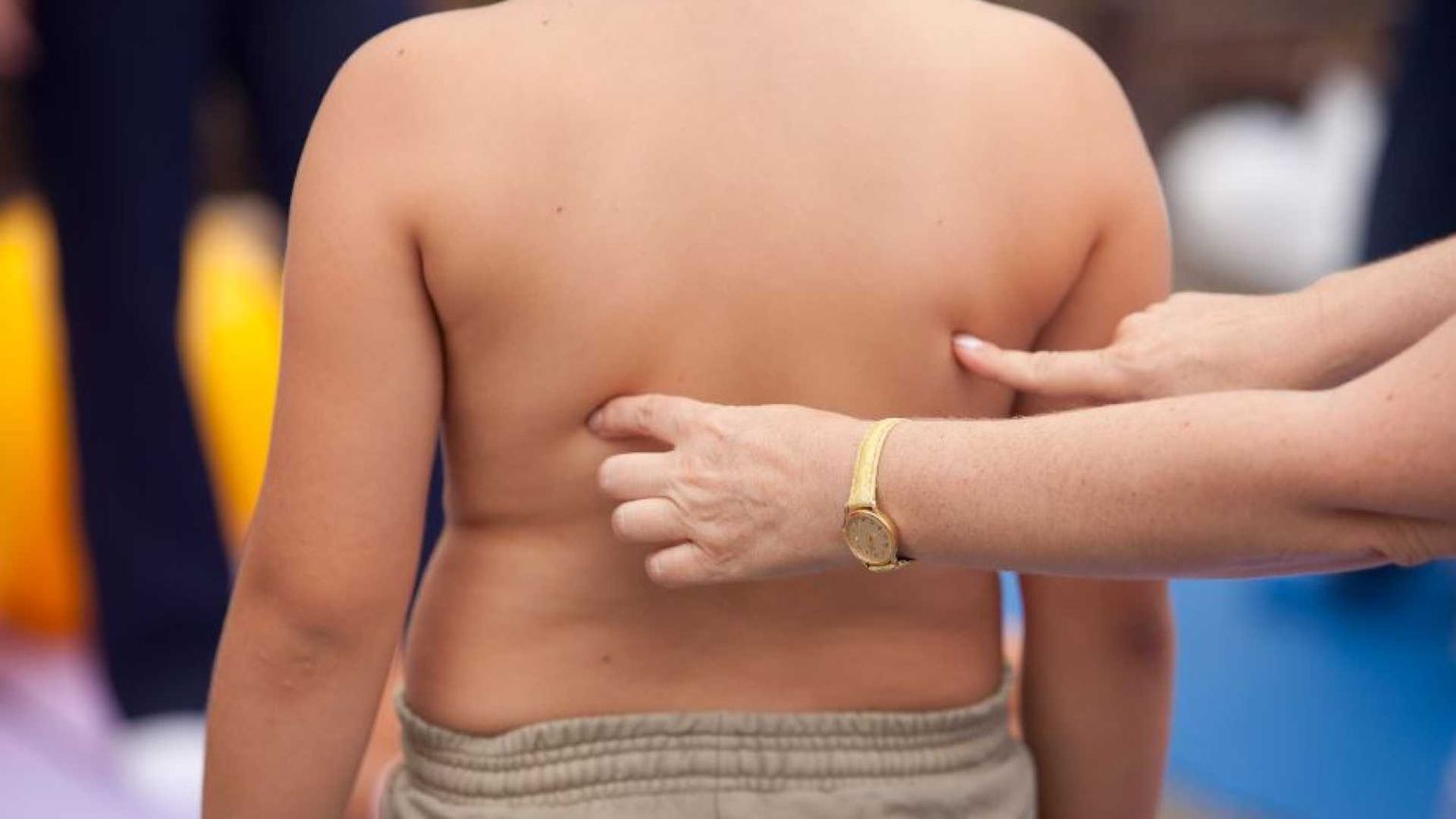 Epidemia di obesità, come si ferma?