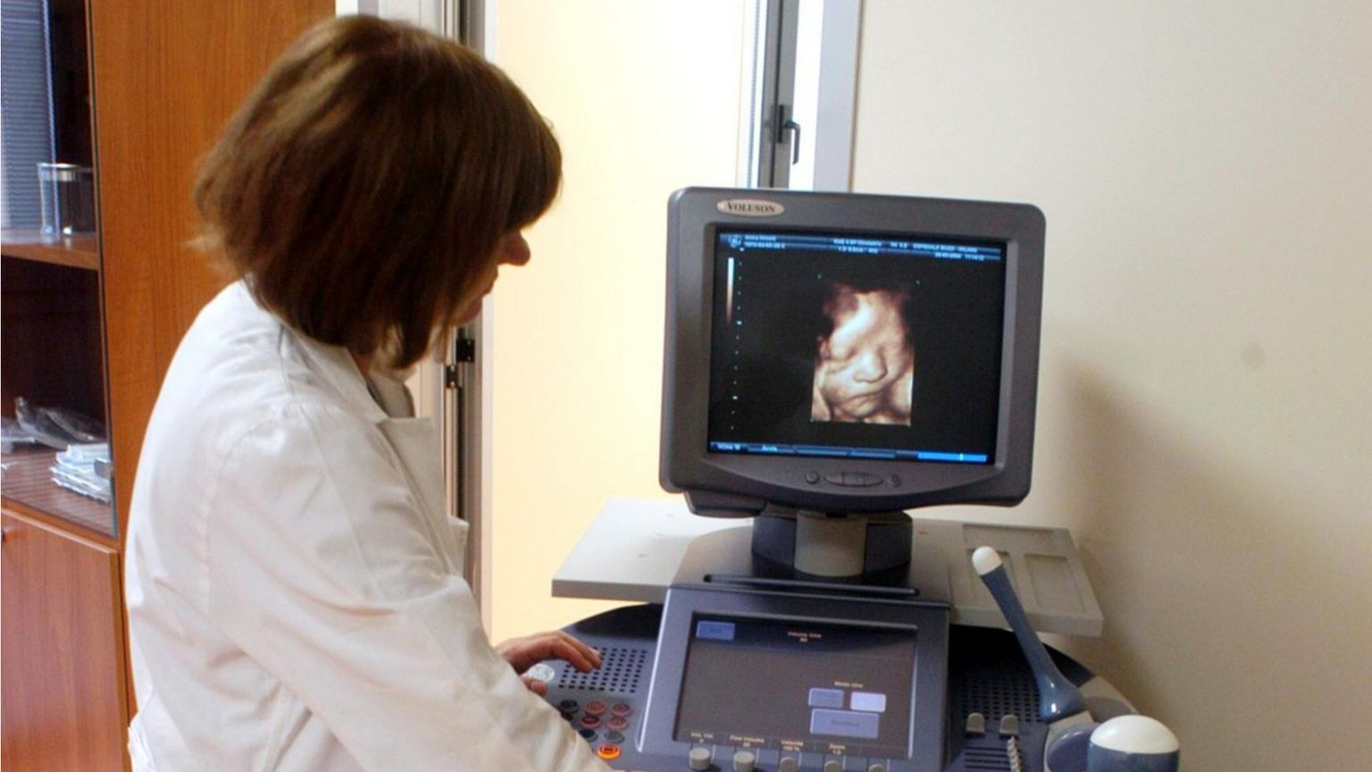 Quando il concepito diventa un paziente