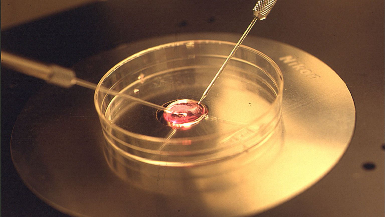 Nati in provetta malati di tumore, scandalo in Danimarca