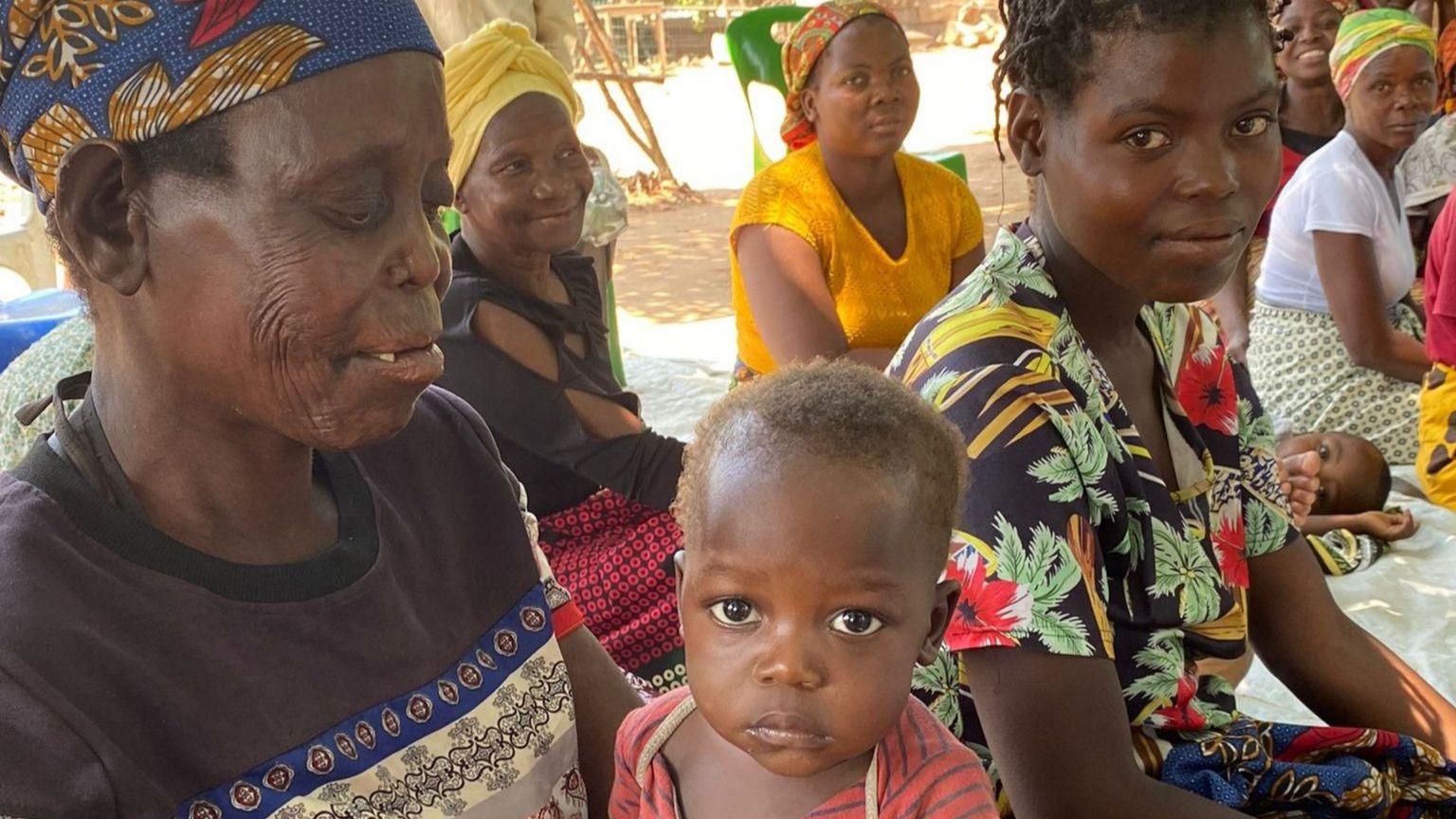La Giornata dei malati di lebbra: dove ci si ammala, come si cura
