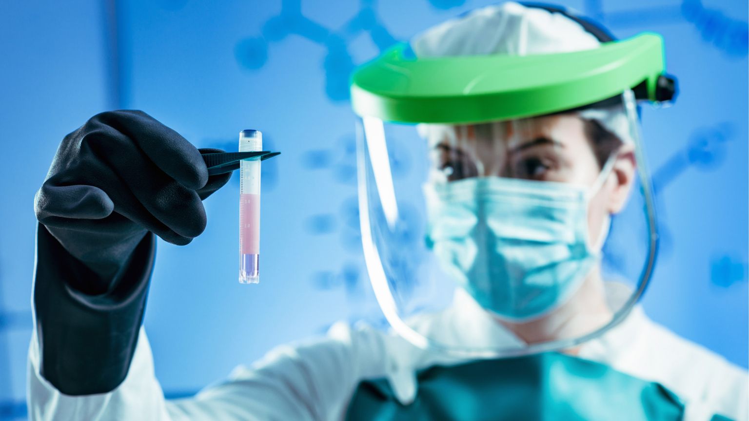 L’azienda che offre di congelare gli ovociti congela anche il (vero) welfare