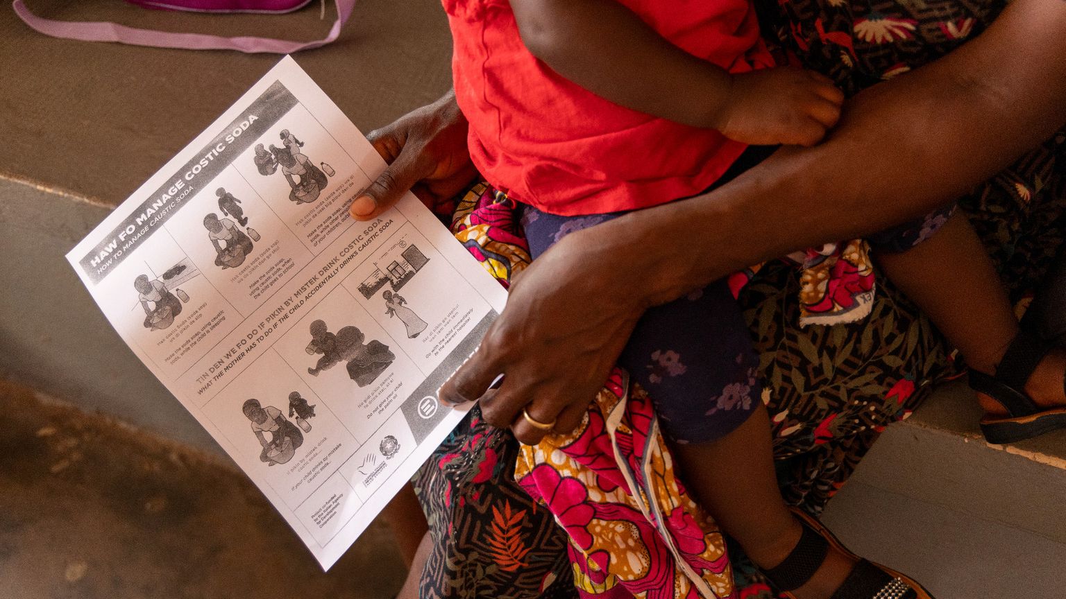 In Sierra Leone la tragica storia dei bambini “bruciati” dalla soda