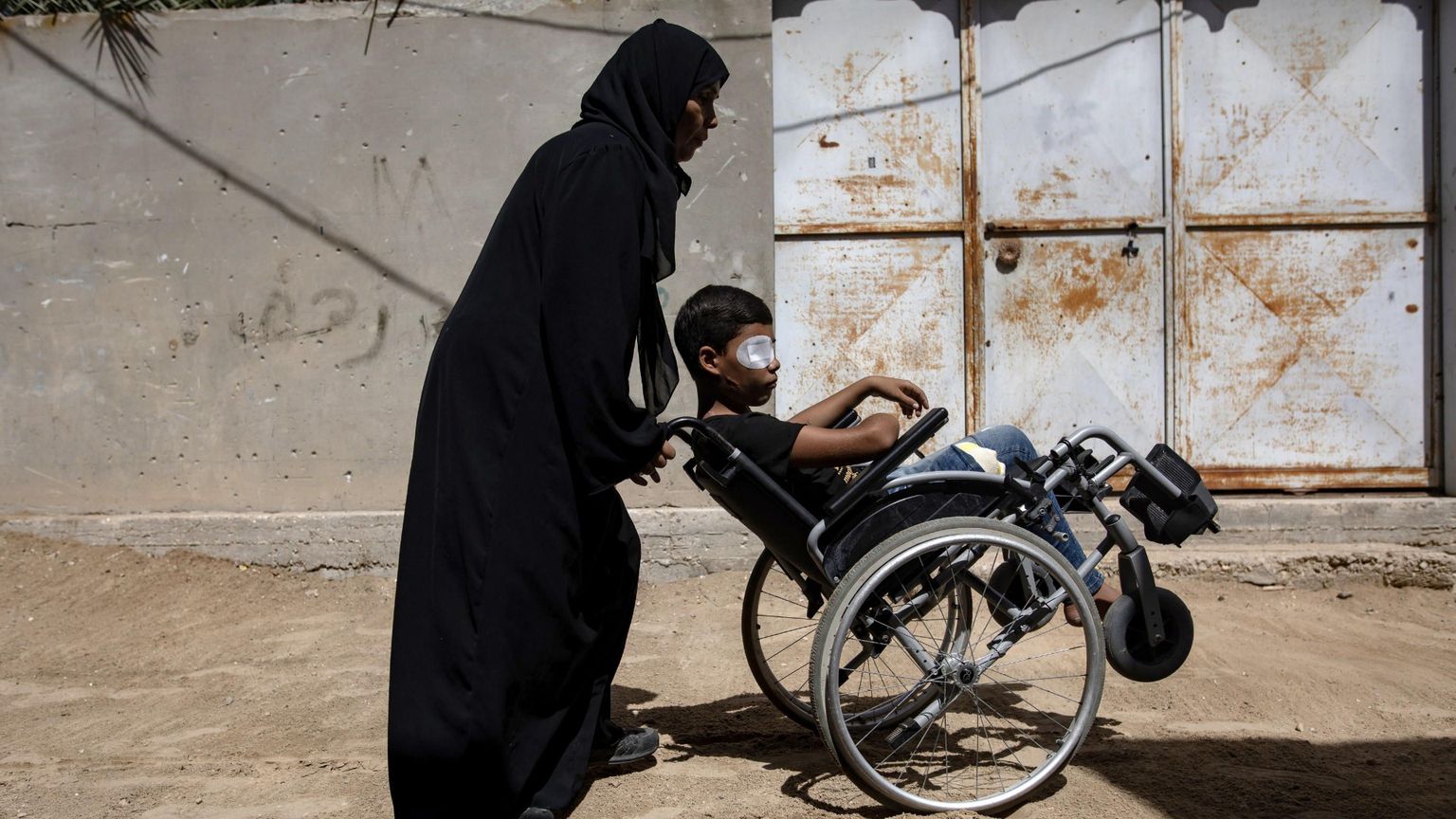 Tende infestate di topi e parassiti, malformazioni: le piaghe di Gaza