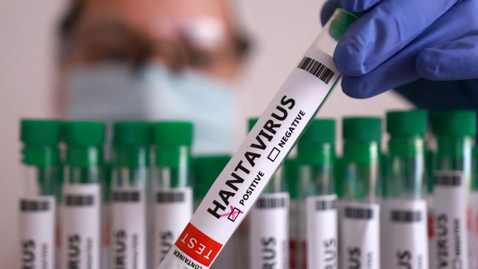 Un test positivo all'hantavirus