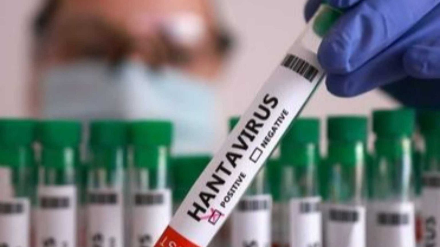 Hantavirus, ecco le misure per prevenire la diffusione