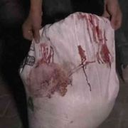 La dignità negata in un sacco di farina insanguinato a Gaza