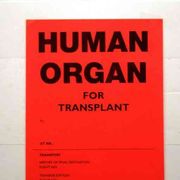 Trent'anni dopo, il dono di Nicholas Green dà ancora frutto