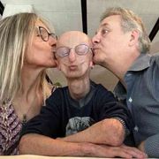 I genitori di Sammy Basso: «Ci ha insegnato a vivere una vita piena»