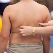 Un bambino su 3 in eccesso di peso: troppo cibo e poco movimento