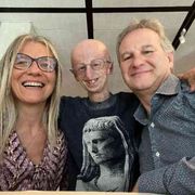 «Mio figlio Sammy Basso e gli studi per curare la malattia (ma non per sé)»