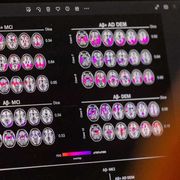 Il fine vita in anticamera e il testa-coda della Corte Costituzionale