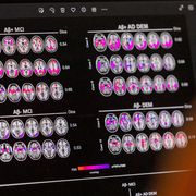 «Non giudico chi soffre, c’è una soglia da rispettare»