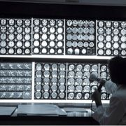 «Via gli ostacoli ai sogni dei bambini con disabilità visiva»