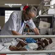 Sierra Leone, i bambini bruciati dalla soda