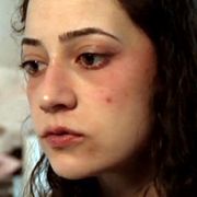 L’eutanasia di Noelia, paraplegica: la Spagna si interroga sulla morte per chi soffre