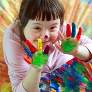 Sindrome di Down, una scoperta italiana può dare la svolta