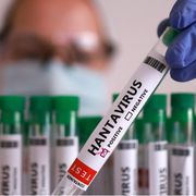 Un test positivo all'hantavirus